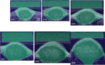 Mouse tumor B-mode image
